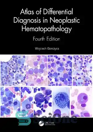 دانلود کتاب Atlas of Differential Diagnosis in Neoplastic Hematopathology – اطلس تشخیص افتراقی در هماتوپاتولوژی نئوپلاستیک